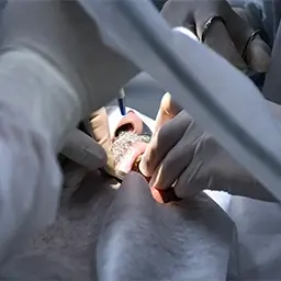 Procedimento odontol&oacute;gico realizado por profissionais com instrumentos cl&iacute;nicos