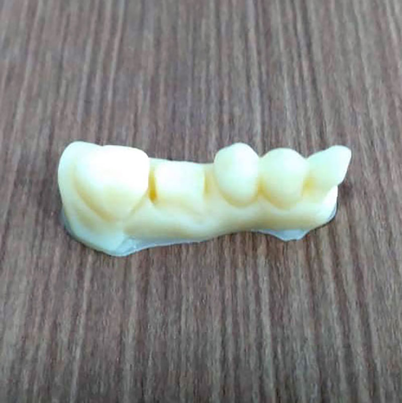 Odontologia: Dentes impressos em 3D